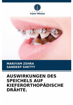 Auswirkungen Des Speichels Auf Kieferorthopädische Drähte.