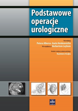 Podstawowe operacje urologiczne