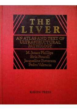 The liver An atlas and text of ultrastructural pathology