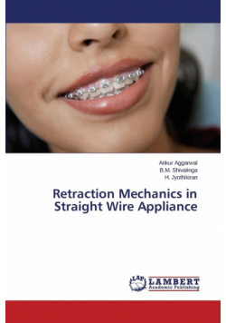 Retraction Mechanics in Straight Wire Appliance