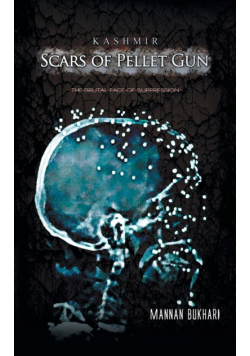 Kashmir - Scars of Pellet Gun