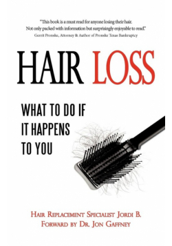 Hair Loss
