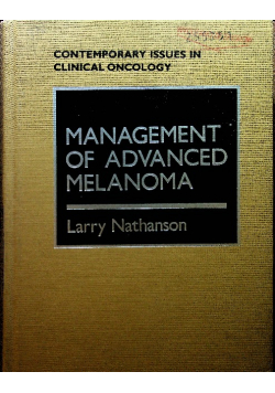 Management of Advanced Melanoma
