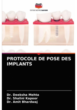 Protocole De Pose Des Implants