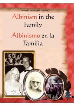 Albinism in the Family