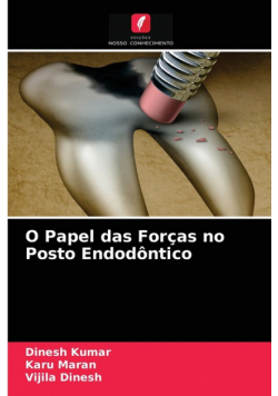 O Papel das Forças no Posto Endodôntico