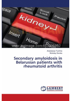 Secondary amyloidosis in Belarusian patients with rheumatoid arthritis