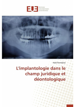 L'implantologie dans le champ juridique et déontologique
