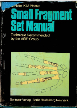 Small fragment set manual