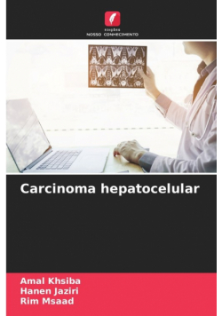 Carcinoma hepatocelular