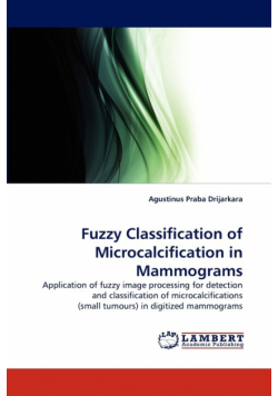Fuzzy Classification of Microcalcification in Mammograms