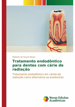 Tratamento endodôntico para dentes com cárie de radiação