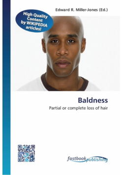 Baldness